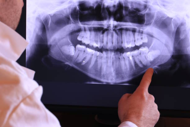 Best Broken or Cracked Tooth Emergency Dentist in Marshall, WI