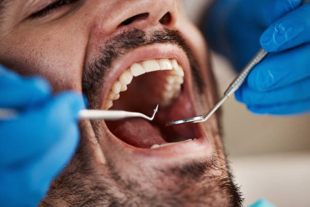Best Emergency Dental Care for Abscessed Tooth in Marshall, WI